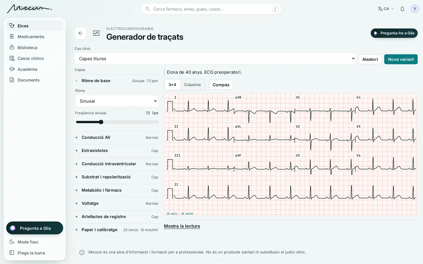 Generador de traçats d'ECG: dotze derivacions sobre paper mil·limetrat i els paràmetres per capes (ritme, conducció, repolarització…).