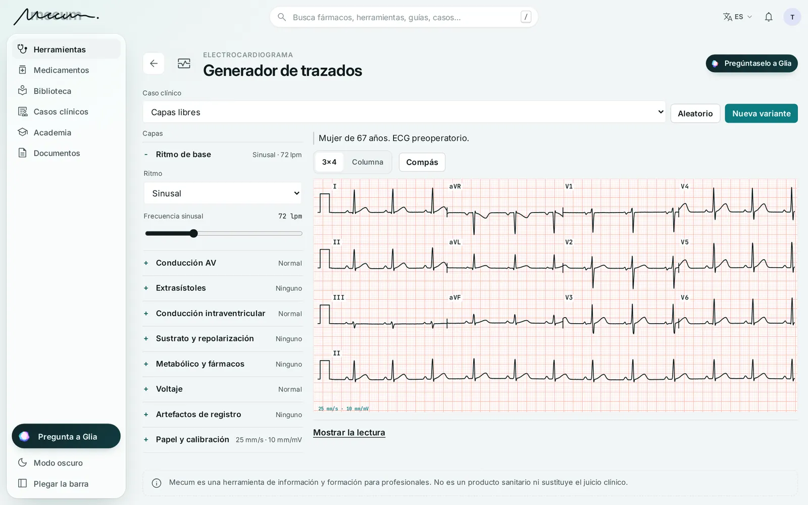 Generador de trazados de ECG: doce derivaciones sobre papel milimetrado y los parámetros por capas (ritmo, conducción, repolarización…).